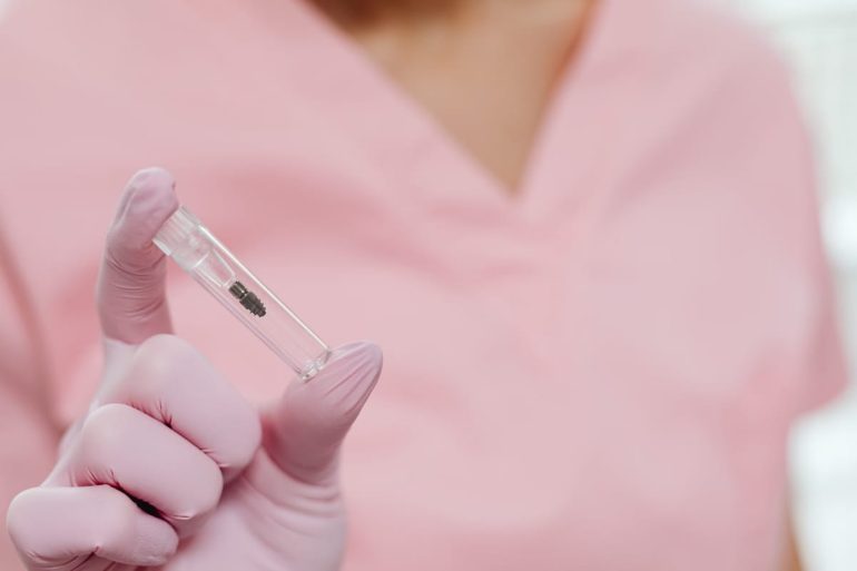 Comment savoir si vous êtes éligible pour un implant dentaire ?